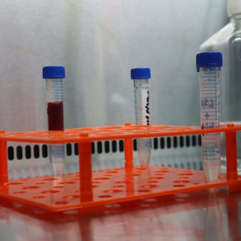 lab results